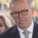 ANTHONY ALBANESE VILLAGE IDIOT meme