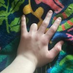 ToadyTheToads fat hand