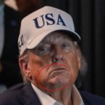 Trumps stroke face