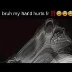 my hand hurts fr meme