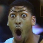 Anthony Davis Shocked