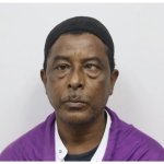 Guy from instagram with vision problems or something