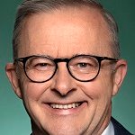 Anthony Albanese Smile