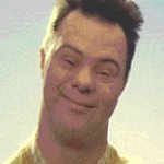 Down syndrome Steveo