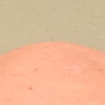 Bold head single hair