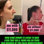 Funny | Now some dummy is going to have a kid that has a  wind sail on their face because of this false advertisement. | image tagged in funny,false advertising,plastic surgery,dating,women vs men,men vs women | made w/ Imgflip meme maker