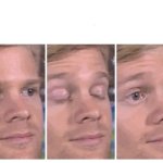 Blinking guy