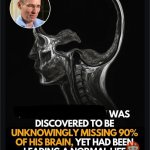 Moba brain