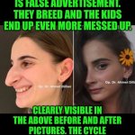 Funny | Broads keep getting plastic surgery which is false advertisement. They breed and the kids end up even more messed up. Clearly visible in the above before and after pictures. The cycle continues as the gene pool gets worse and worse. The end. | image tagged in funny,plastic surgery,dating,dating sucks,genetics,false advertising | made w/ Imgflip meme maker