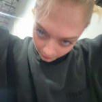 Big forehead