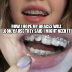 #braces | How I hope my braces will look, cause they said I might need it | image tagged in braces | made w/ Imgflip meme maker