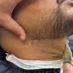 Funny | I see a billion ingrown hairs in his future | image tagged in funny,barber,hairstyle,hair,shaving,mistake | made w/ Imgflip meme maker