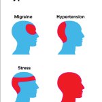 Types of Headaches