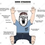 Down's Syndrome soyjak