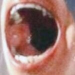 Nose