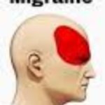 Migraine