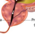 Prostate Gland template