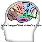 Actual image of the inside of my brain | food; furry characters; dragons; fandom; videos I watched; sleep; cartoons; games | image tagged in actual image of the inside of my brain | made w/ Imgflip meme maker