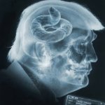 X-ray of Trump's brain, if any. Suspicious brown matter found. meme