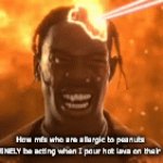 could never be me | How mfs who are allergic to peanuts GENUINELY be acting when I pour hot lava on their head | image tagged in gifs,funny | made w/ Imgflip video-to-gif maker