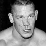 John Cena Swollen Nose