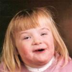 Down syndrome girl