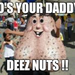 deez nuts | WHO'S YOUR DADDY ?? DEEZ NUTS !! | image tagged in deez nuts | made w/ Imgflip meme maker