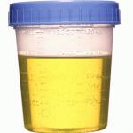 Urine sample