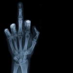 xray finger