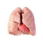 Healthy lungs
