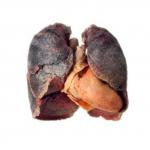 Smoker sick unhealthy lungs