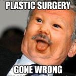 Derp Meme | PLASTIC SURGERY; GONE WRONG | image tagged in derp meme | made w/ Imgflip meme maker