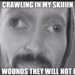 CRAWLING IN MY SKIN | CRAWLING IN MY SKIIIIN; THESE WOUNDS THEY WILL NOT HEAAAL | image tagged in crawling in my skin | made w/ Imgflip meme maker