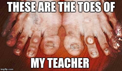 Ugly Feet | THESE ARE THE TOES OF; MY TEACHER | image tagged in ugly feet | made w/ Imgflip meme maker