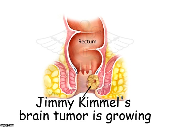 Jimmy Kimmel's brain tumor growing | Jimmy Kimmel's; brain tumor is growing | image tagged in anus,jimmy kimmel,brain tumor | made w/ Imgflip meme maker