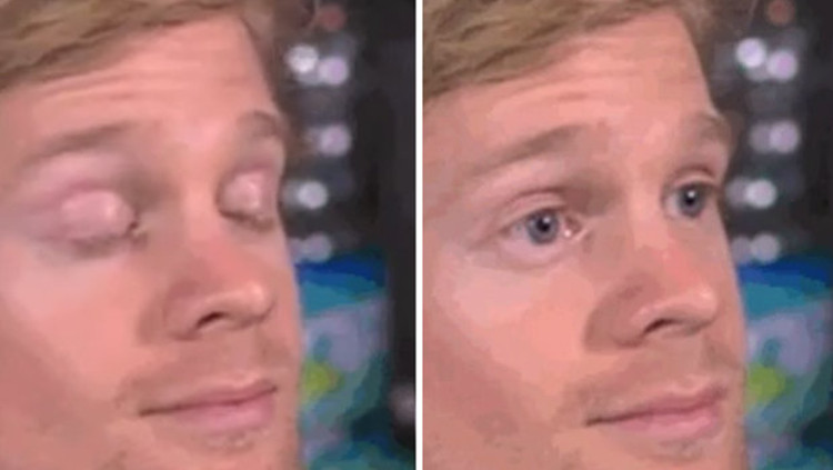 Drew Scanlon Reaction Blank Meme Template