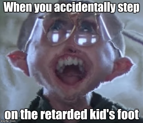 When you accidentally step on the retarded kid's foot | When you accidentally step; on the retarded kid's foot | image tagged in retarded,let me see your war face | made w/ Imgflip meme maker