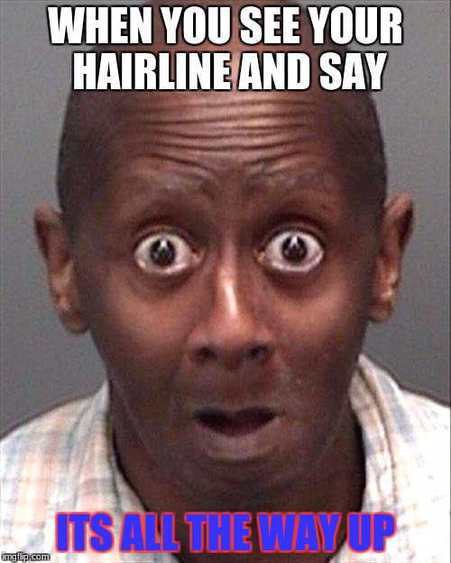 Funny Face | WHEN YOU SEE YOUR HAIRLINE AND SAY; ITS ALL THE WAY UP | image tagged in funny face | made w/ Imgflip meme maker