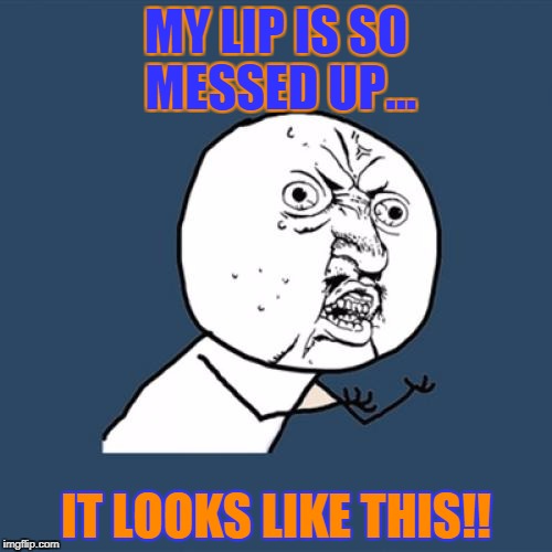 Y U No Meme | MY LIP IS SO MESSED UP... IT LOOKS LIKE THIS!! | image tagged in memes,y u no | made w/ Imgflip meme maker