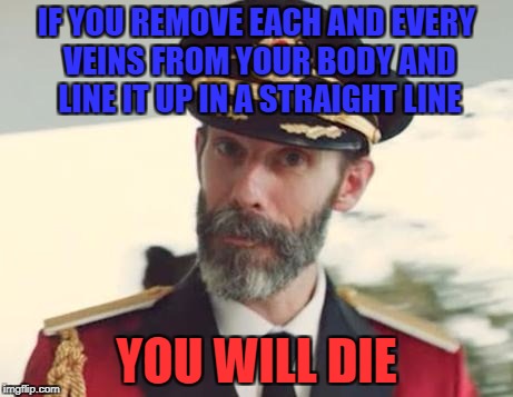 Captain Obvious | IF YOU REMOVE EACH AND EVERY VEINS FROM YOUR BODY AND LINE IT UP IN A STRAIGHT LINE; YOU WILL DIE | image tagged in captain obvious,memes,funny,ssby | made w/ Imgflip meme maker