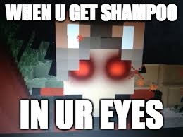 WHEN U GET SHAMPOO; IN UR EYES | image tagged in shampoo,eyes | made w/ Imgflip meme maker