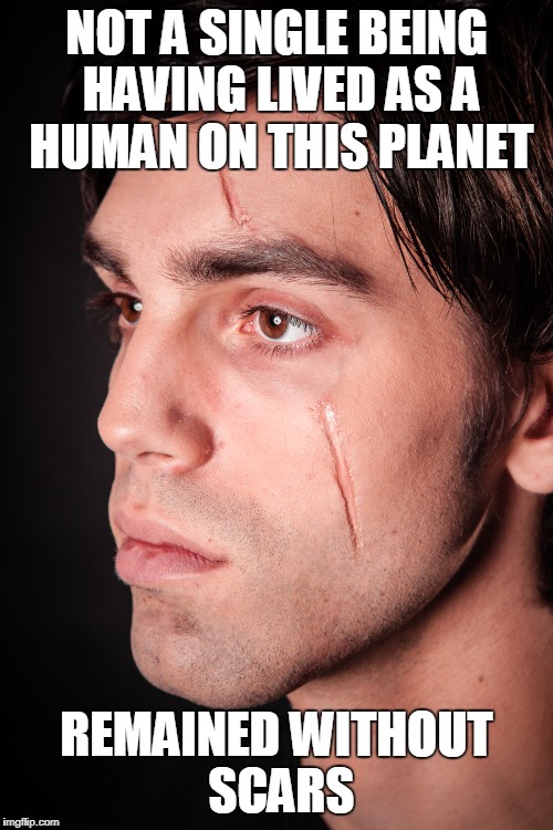 NOT A SINGLE BEING HAVING LIVED AS A HUMAN ON THIS PLANET REMAINED WITHOUT SCARS | made w/ Imgflip meme maker