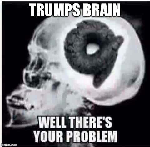 Trump has shit for brains!! | TRUMPS BRAIN | image tagged in trump meme,trump tax plan meme,donald trump is an idiot,nevertrump meme,anti trump meme | made w/ Imgflip meme maker