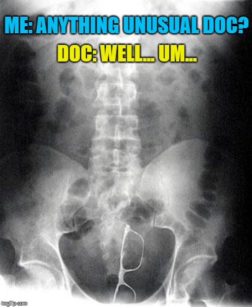 Define Unusual For Me | ME: ANYTHING UNUSUAL DOC? DOC: WELL... UM... | image tagged in memes,meme,doctor,doctors,funny,funny memes | made w/ Imgflip meme maker