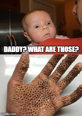 Gave me goose bumps O.O | DADDY? WHAT ARE THOSE? | image tagged in memes,awesome,fear,holes,wtf | made w/ Imgflip meme maker