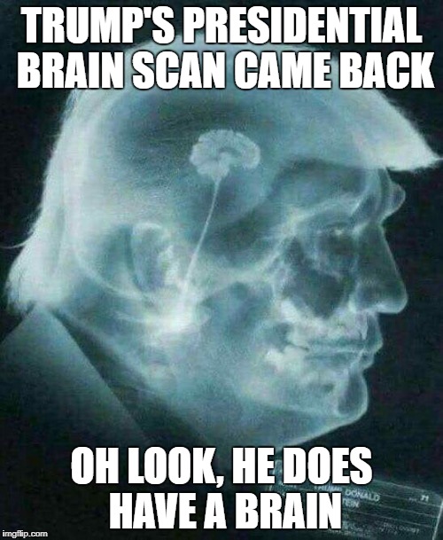 TRUMP'S PRESIDENTIAL BRAIN SCAN CAME BACK; OH LOOK, HE DOES HAVE A BRAIN | image tagged in trumpsbrain | made w/ Imgflip meme maker