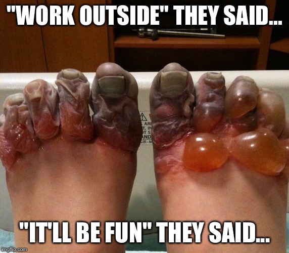Frostbite | "WORK OUTSIDE" THEY SAID... "IT'LL BE FUN" THEY SAID... | image tagged in frosty | made w/ Imgflip meme maker