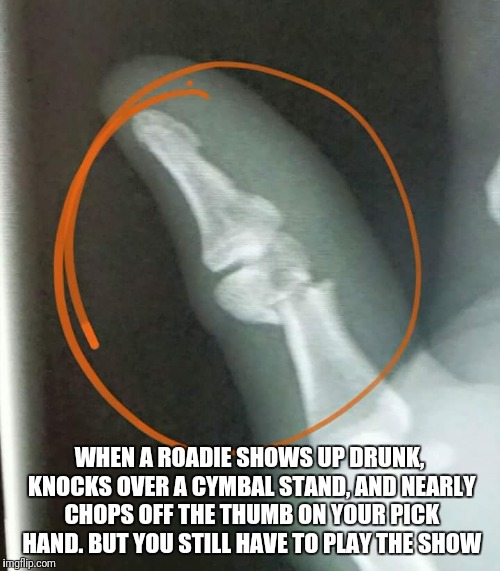 WHEN A ROADIE SHOWS UP DRUNK, KNOCKS OVER A CYMBAL STAND, AND NEARLY CHOPS OFF THE THUMB ON YOUR PICK HAND. BUT YOU STILL HAVE TO PLAY THE SHOW | image tagged in music,roadie,broken bone | made w/ Imgflip meme maker