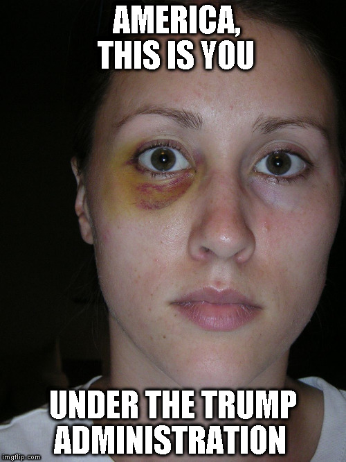 America under Trump | AMERICA, THIS IS YOU; UNDER THE TRUMP ADMINISTRATION | image tagged in rob porter wife,anti-trump | made w/ Imgflip meme maker
