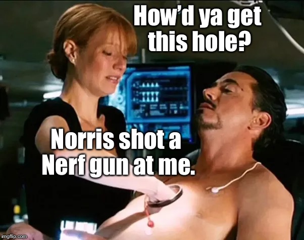 How’d ya get this hole? Norris shot a Nerf gun at me. | made w/ Imgflip meme maker